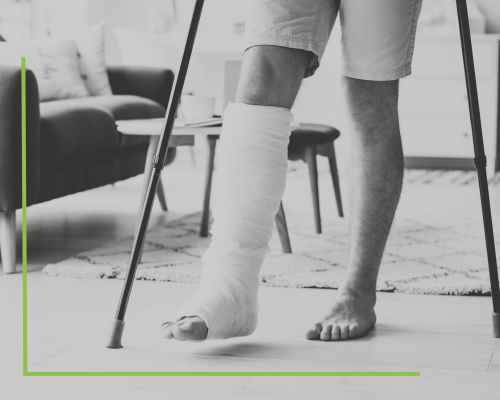 Image of a leg broken and in a cast. Learn more at Jason Kisner, a Premises Liability attorney in Prince George's County, Anne Arundel County Maryland, and Washington DC.